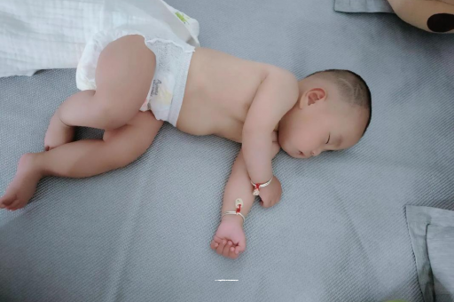 黔南六个月宝宝眼睛散光